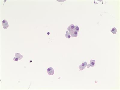 Molecular Characterization of Thyroid Follicular Lesions in the Era of “Next-Generation” Techniques